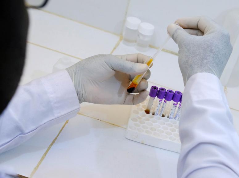 Manipulating test tubes in the laboratory, Maradi, Niger