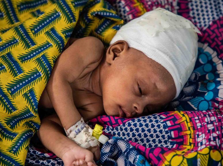 New-born suffering from malnutrition, Niger