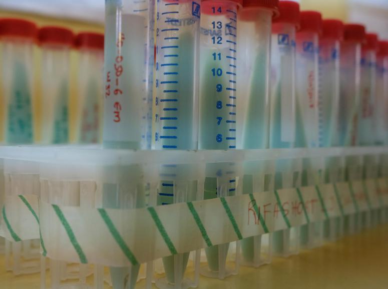 Test tubes in the laboratory in Mbarara