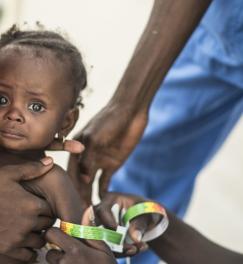 Le périmètre brachial ('MUAC') est une méthode simple d'identification des jeunes enfants malnutris.