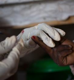 A child is tested for kala azar at the Médecins Sans Frontières (MSF) hospital in Lankien, South Sudan