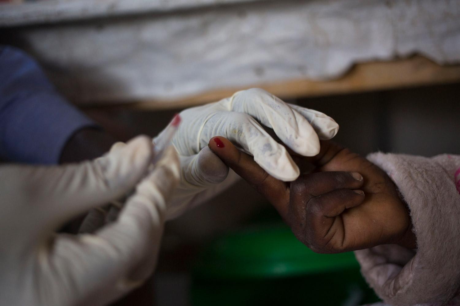 A child is tested for kala azar at the Médecins Sans Frontières (MSF) hospital in Lankien, South Sudan